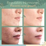 1/2x Green Tea Cleansing Mask Facial Stick Oil Acne Control Blackhead Deep Clean