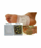 Detox Foot Patch Pads Natural plant Toxin Removal Sticky Adhesives